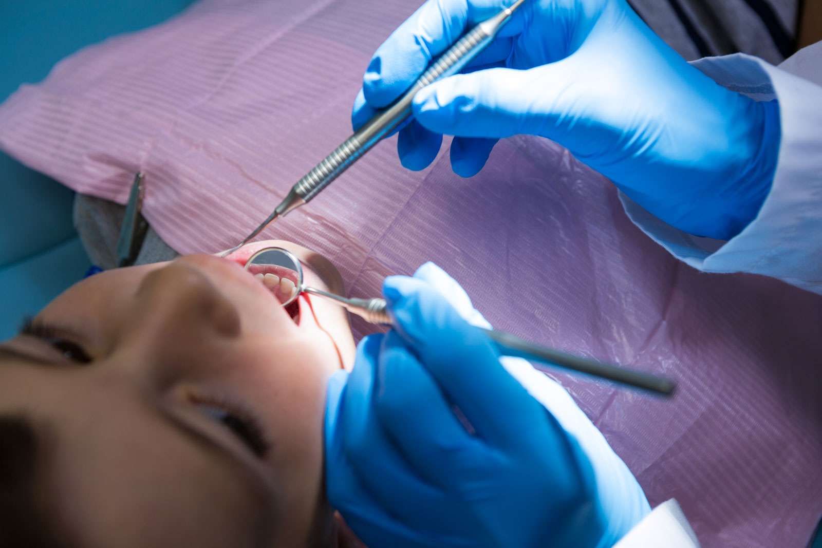 Dolore dopo la devitalizzazione: cosa aspettarsi 1 Un dente devitalizzato fa male?