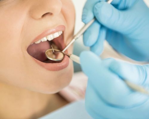 Implantologia dentale a Lucca: tecnologia e precisione per il ripristino dei denti 9 igene orale a Lucca