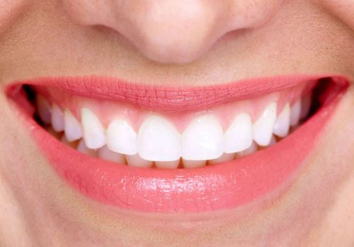 Cosa sapere sulle soluzioni fai da te per lo sbiancamento dentale