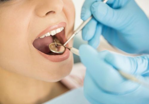 il Sorriso è Servito 1 Quando hai fatto l’igiene?