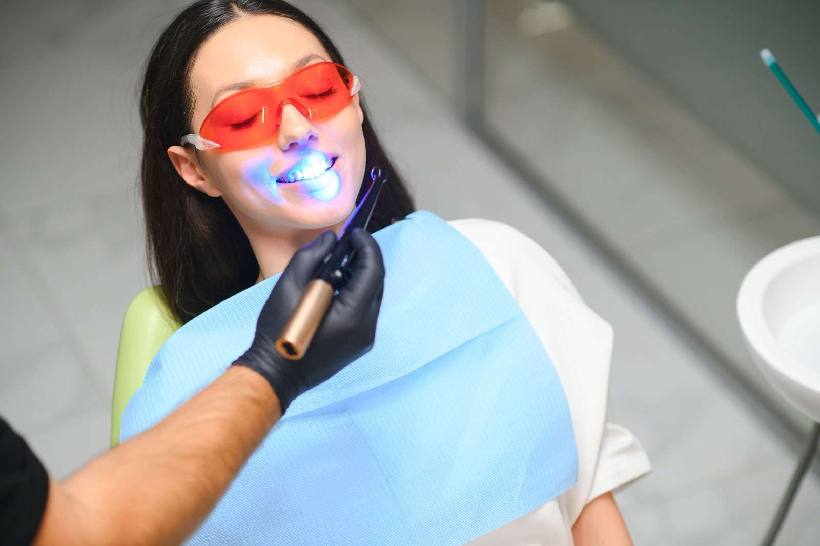 Tutto quello che devi sapere sullo sbiancamento dentale a Lucca 1 Tutto quello che devi sapere sullo sbiancamento dentale a Lucca