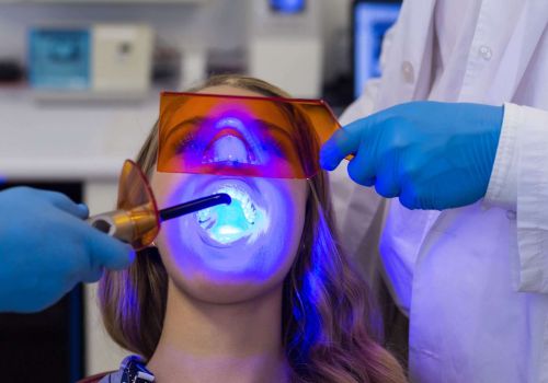 Il momento ideale per lo sbiancamento dentale