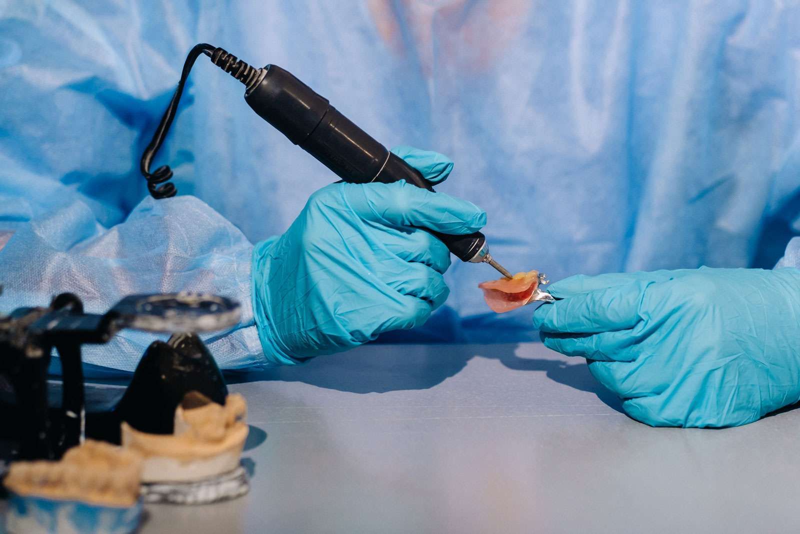 Osteointegrazione negli impianti dentali: un processo fondamentale 1 Che cos'è l'osteointegrazione?