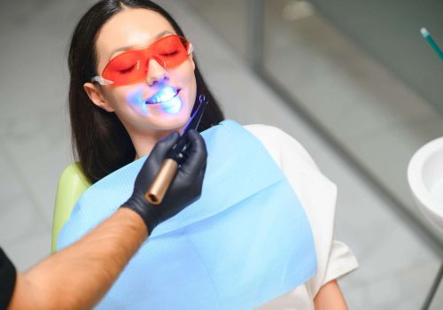 Tutto quello che devi sapere sullo sbiancamento dentale a Lucca